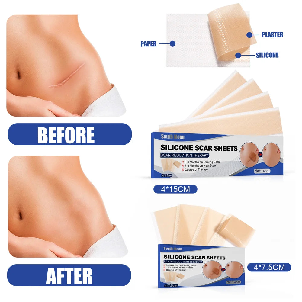 SOUTH MOON 4Pcs Silicone Scar Sheets Self Adhesive Burn Wound Healing Skin Smoothing Patches - 4