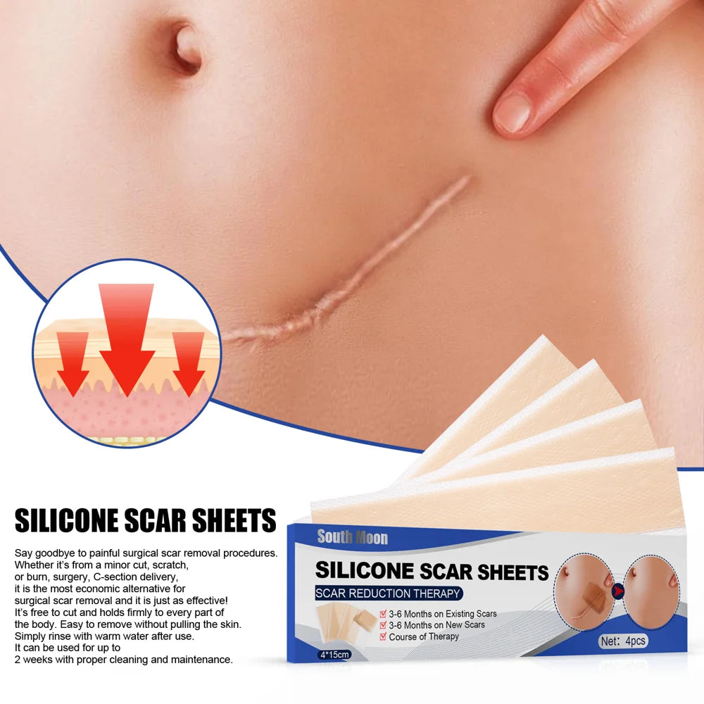 SOUTH MOON 4Pcs Silicone Scar Sheets Self Adhesive Burn Wound Healing Skin Smoothing Patches - 5