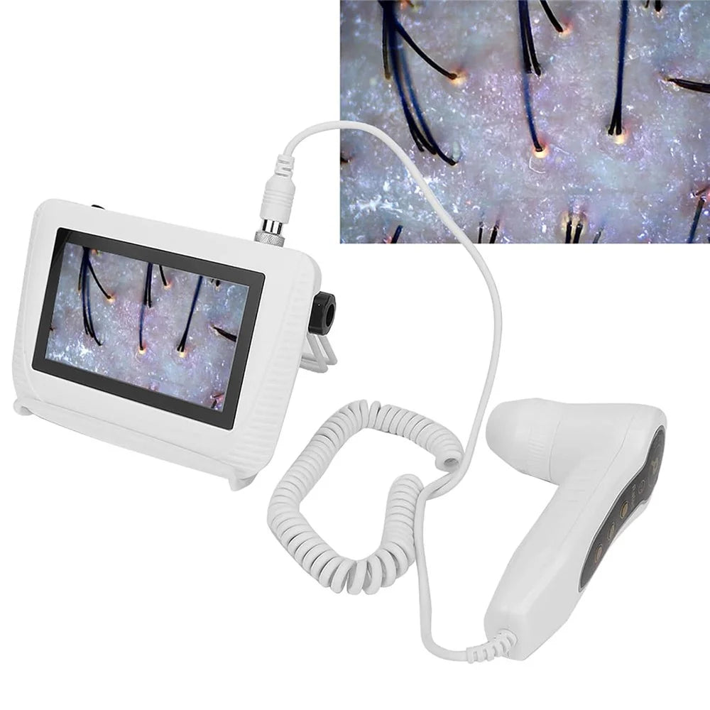 5 Inch Scalp Detector Digital Skin Analyzer Live Image Skin Microscope with 50X / 200X Magnification Lens - US Plug - 2