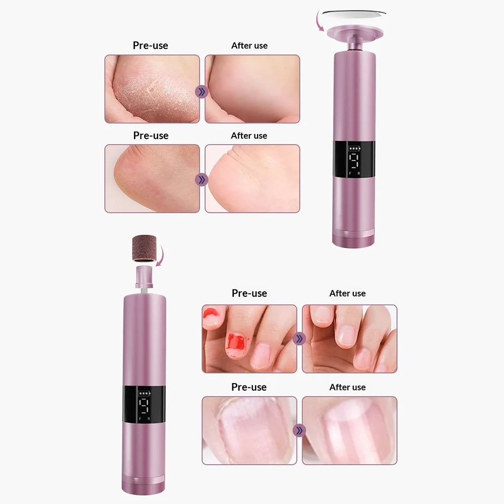 GML-21 Electric Foot File 9 Speed Levels Dead Skin Callus Remover LCD Display Pedicure Tool for Salon Home - Black - 5