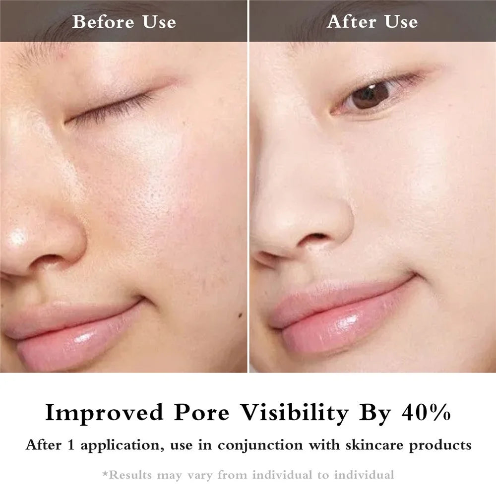 2405 EMS Microcurrent Eye Beauty Device with Hot Compress LED Vibration Eye Skin Care Wand - Black - 4