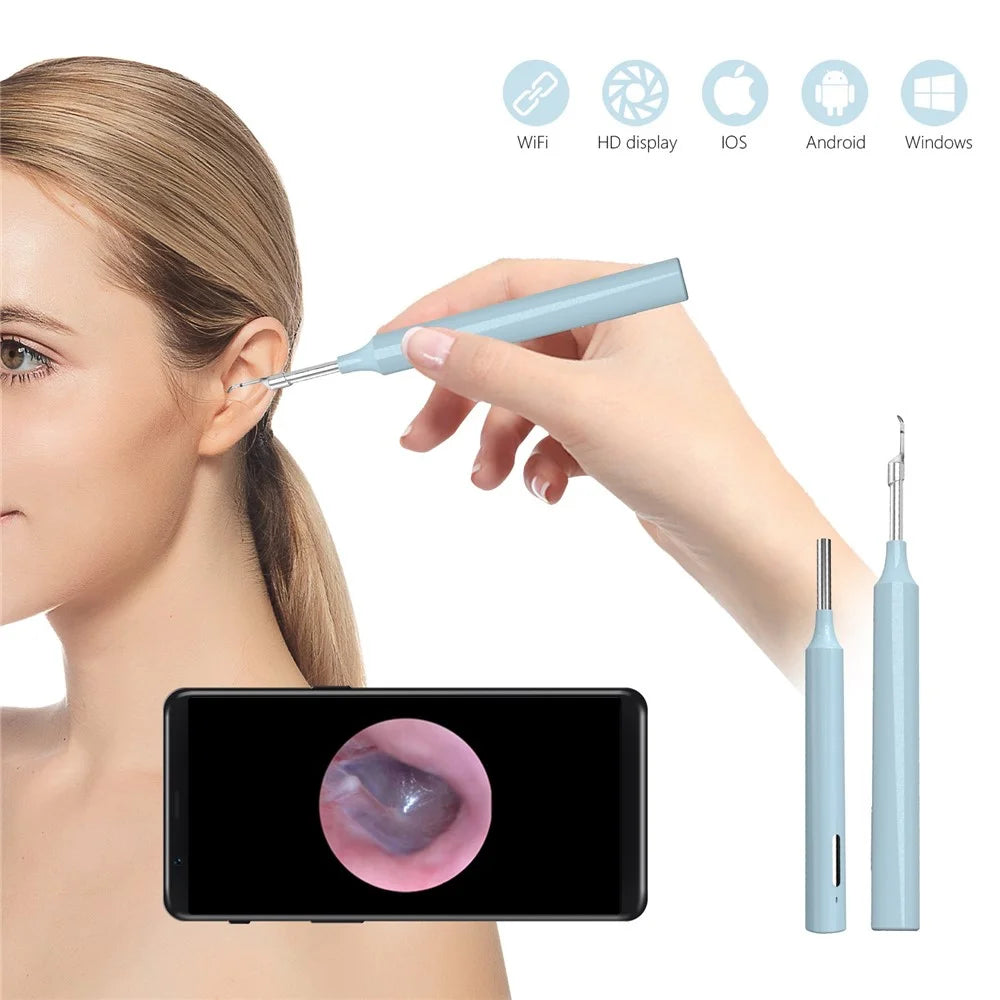Z10 WiFi Visual Earwax Removal Tool Wireless Earwax Cleaner Digital Otoscope Ear Wax Cleaning Tool - Blue - 2