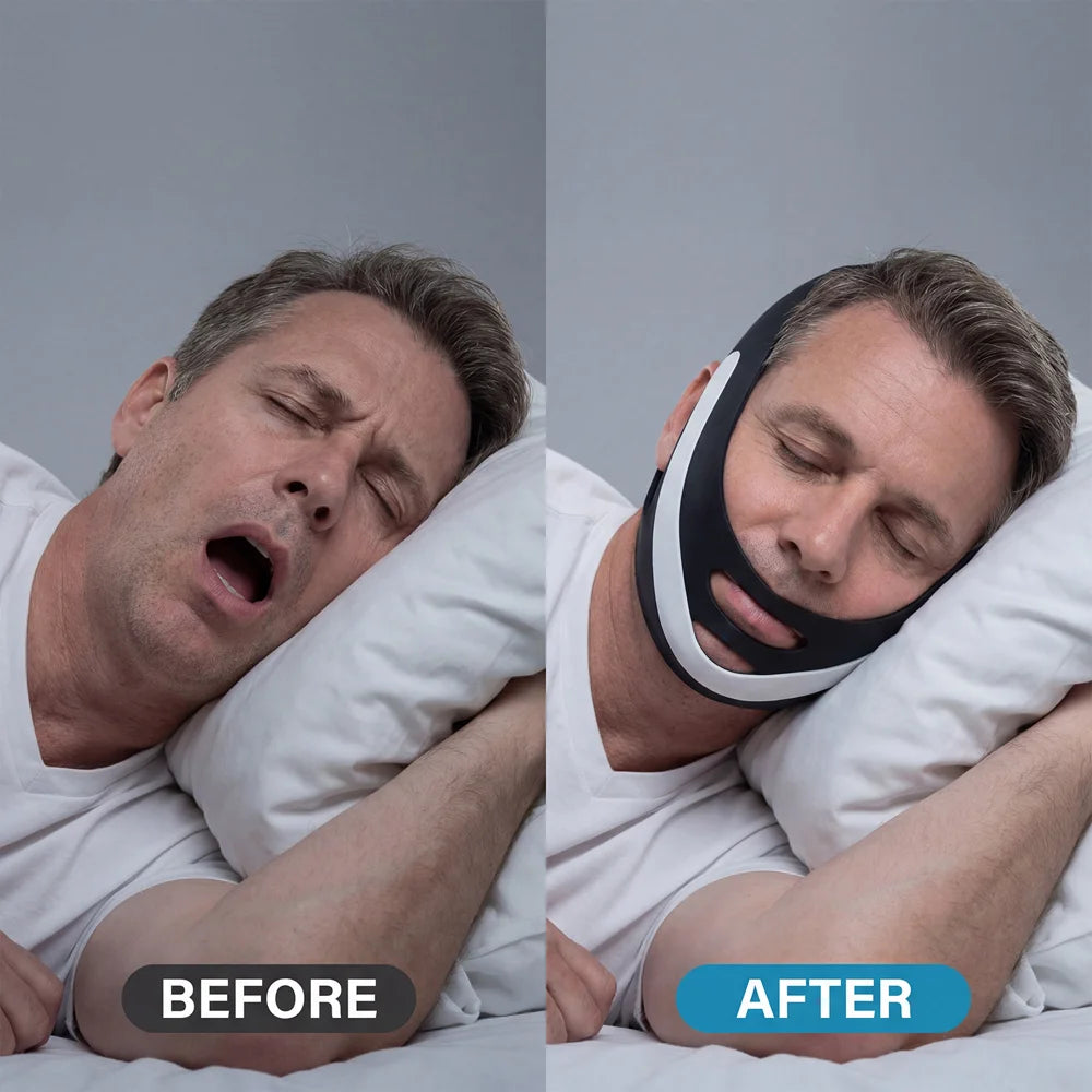TORVIKX Stop Snoring Elastic Chin Strap Anti Snoring Sleep Aid Adjustable Snore Reduction Chin Belt - 7