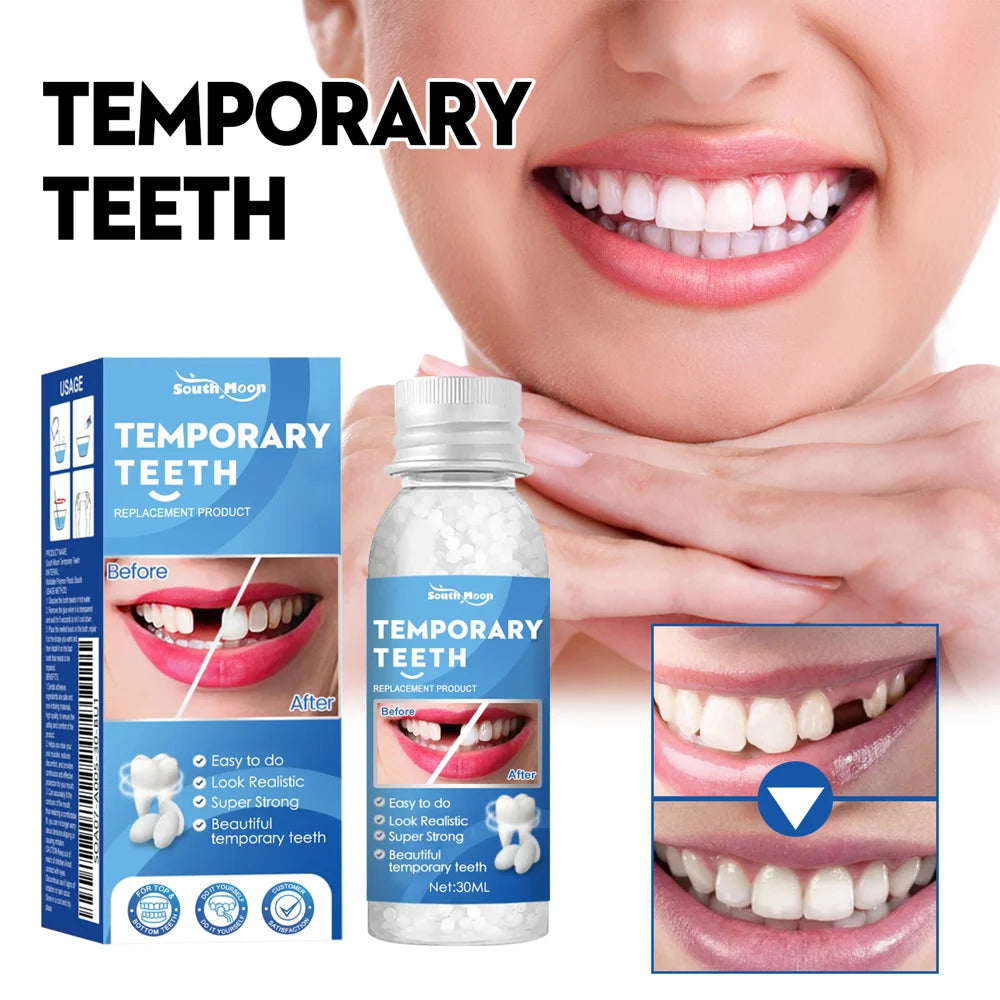 SOUTH MOON 30ml Temporary Teeth Replacement Filling Kit Moldable False Teeth Beads for Missing, Cracked DIY Denture - 2