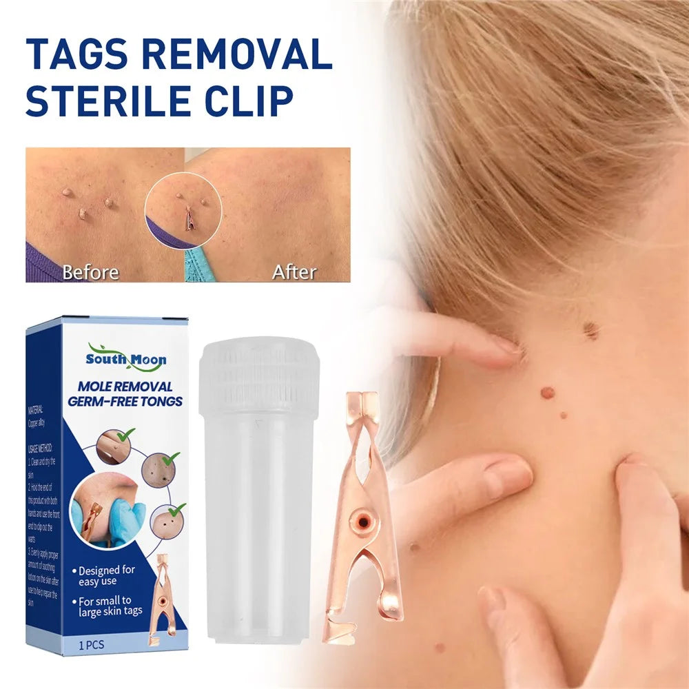 SOUTH MOON SOA08-A088-1-BU1 Painless Skin Tag Mole Wart Spot Removal Clip Body Wart Treatment Foot Corn Remover - 2