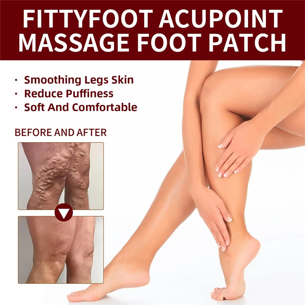 XIMONTH XIA03-A005-5-RD1 5 Pairs Acupoint Massage Foot Patch Relieve Venous Swelling Foot Care Pad - 2