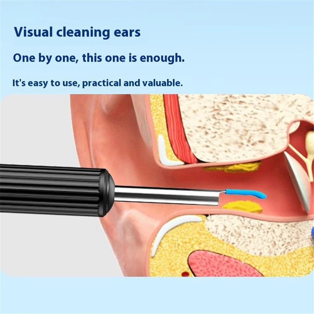 Visual Ear Cleaning Endoscope with LED Light Earwax Removal Tool Kit, Standard Version - Black - 2