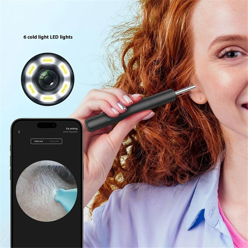 WiFi Visual Ear Cleaning Endoscope Earpick with LED Light Ear Wax Removal Tool with 8 Accessories - Black - 4