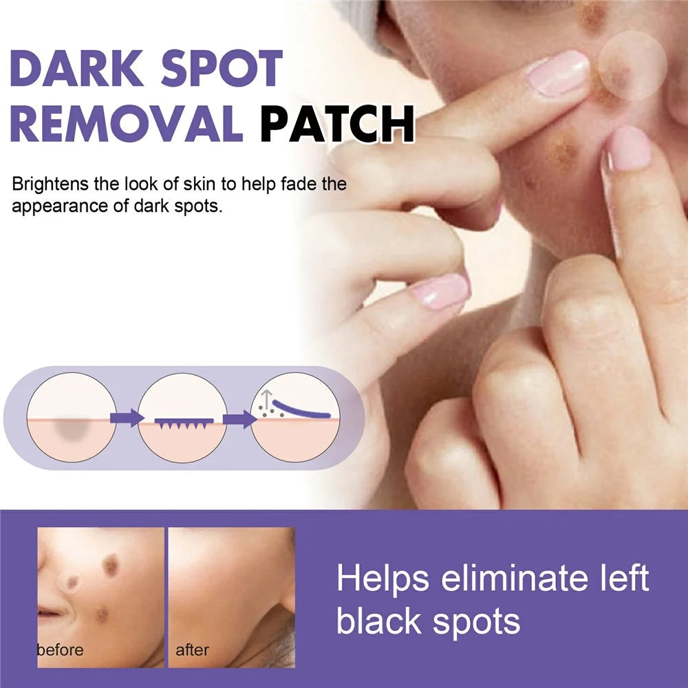 EELHOE 144Pcs Spot Treatment Patches Dark Spot Remover Skin Brightening Stickers, EEA08-A113-144-VT1 - 4